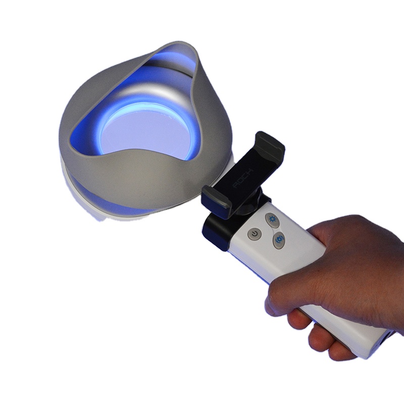 皮膚疾患 色素沈着異常および色素過多の検査と診断 カーネルメ - Led Medical Headlight のレビューと価格