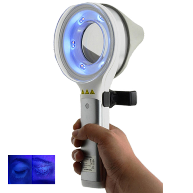 皮膚疾患 色素沈着異常および色素過多の検査と診断 カーネルメ - Led Medical Headlight のレビューと価格